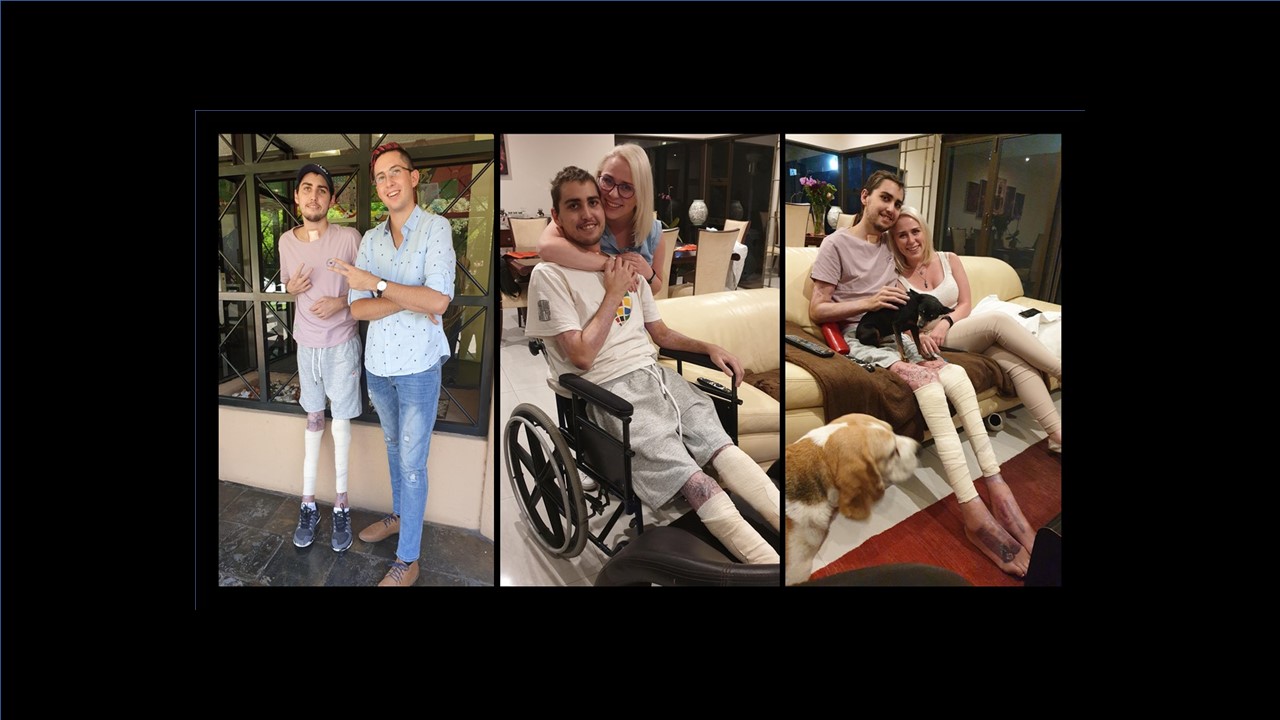 Sheer willpower enables injured paraglider to defy the odds